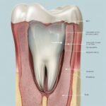 Broken molar illustration